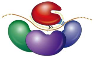 原发性心脏肿瘤有哪些表现?